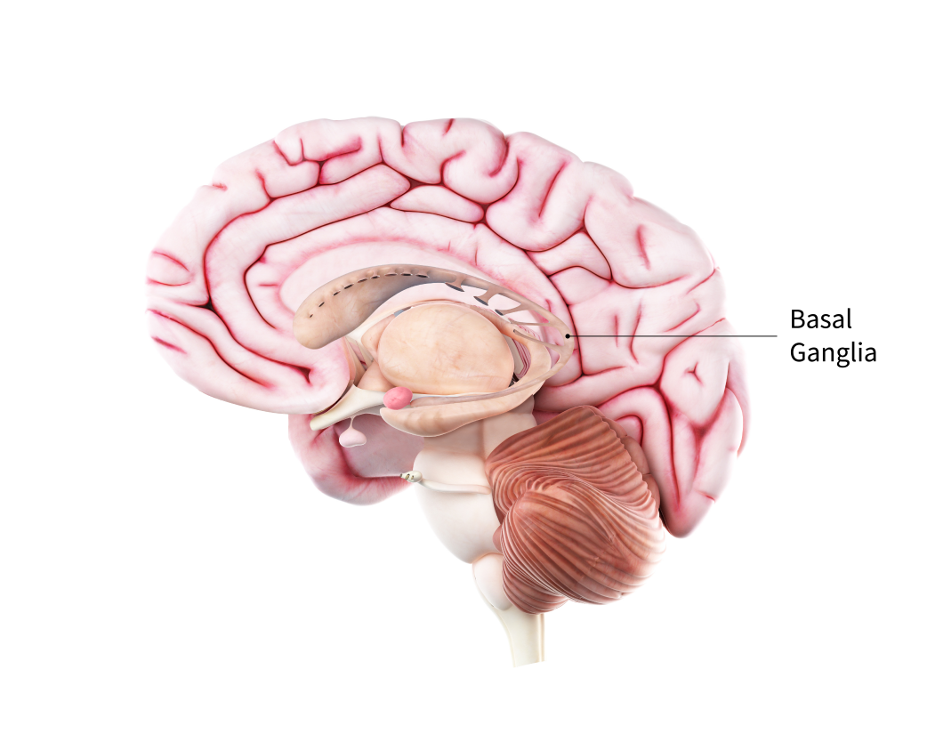 PARKINSON'S DISEASE image